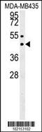 Suppressor Of Variegation 3-9 Homolog 1 antibody, 56-109, ProSci, Western Blot image 