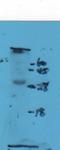 Killer Cell Lectin Like Receptor K1 antibody, orb11136, Biorbyt, Western Blot image 