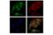 RAB5A, Member RAS Oncogene Family antibody, 46449S, Cell Signaling Technology, Immunofluorescence image 