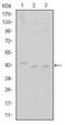 Cyclin Dependent Kinase 9 antibody, MA5-15850, Invitrogen Antibodies, Western Blot image 