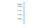 Tetratricopeptide Repeat Domain 1 antibody, A12893, Boster Biological Technology, Western Blot image 