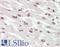 Ribosomal Protein S6 Kinase A3 antibody, LS-B10741, Lifespan Biosciences, Immunohistochemistry frozen image 