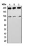 Insulin Like Growth Factor 1 Receptor antibody, orb393322, Biorbyt, Western Blot image 