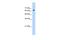 NACC Family Member 2 antibody, A13882, Boster Biological Technology, Western Blot image 