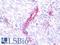 ATP Synthase F1 Subunit Delta antibody, LS-C210995, Lifespan Biosciences, Immunohistochemistry paraffin image 