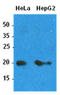 ADP Ribosylation Factor 1 antibody, LS-C139560, Lifespan Biosciences, Western Blot image 