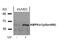 Protein Kinase AMP-Activated Catalytic Subunit Alpha 1 antibody, GTX50224, GeneTex, Western Blot image 