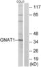 G Protein Subunit Alpha Transducin 1 antibody, abx014519, Abbexa, Western Blot image 