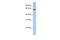 Deuterosome Assembly Protein 1 antibody, A12274, Boster Biological Technology, Western Blot image 