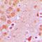 TNF Alpha Induced Protein 8 antibody, orb215103, Biorbyt, Immunohistochemistry paraffin image 