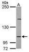 Eukaryotic translation initiation factor 4 gamma 2 antibody, GTX101712, GeneTex, Western Blot image 