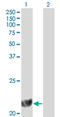 Dihydrofolate Reductase antibody, LS-C197047, Lifespan Biosciences, Western Blot image 