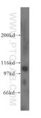 Eukaryotic Elongation Factor 2 Kinase antibody, 13510-1-AP, Proteintech Group, Western Blot image 