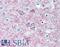 Adenosine A2a Receptor antibody, LS-B2122, Lifespan Biosciences, Immunohistochemistry paraffin image 