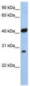 Zinc Finger AN1-Type Containing 3 antibody, TA335486, Origene, Western Blot image 