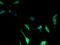 Tetraspanin 14 antibody, A61554-100, Epigentek, Immunofluorescence image 