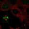 Inner Centromere Protein antibody, NBP2-57266, Novus Biologicals, Immunofluorescence image 
