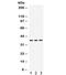 DNA Polymerase Beta antibody, R31898, NSJ Bioreagents, Western Blot image 
