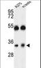 Calcium release-activated calcium channel protein 1 antibody, LS-C163265, Lifespan Biosciences, Western Blot image 