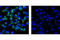 Fibroblast Growth Factor Receptor 3 antibody, 4574S, Cell Signaling Technology, Immunocytochemistry image 