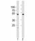 Transcription factor SOX-7 antibody, F52990-0.4ML, NSJ Bioreagents, Western Blot image 