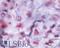 Parathyroid Hormone 1 Receptor antibody, LS-A762, Lifespan Biosciences, Immunohistochemistry paraffin image 