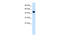 Ephrin B2 antibody, 27-380, ProSci, Enzyme Linked Immunosorbent Assay image 