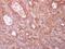 Coronin 1C antibody, GTX115727, GeneTex, Immunohistochemistry paraffin image 