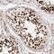 Cell Division Cycle Associated 2 antibody, NBP1-87140, Novus Biologicals, Immunohistochemistry paraffin image 