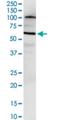 Nudix Hydrolase 12 antibody, H00083594-M01, Novus Biologicals, Western Blot image 