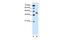 Solute Carrier Family 35 Member B1 antibody, GTX46823, GeneTex, Western Blot image 