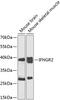 Interferon Gamma Receptor 2 antibody, GTX64548, GeneTex, Western Blot image 