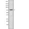 CLK4 Associating Serine/Arginine Rich Protein antibody, abx149367, Abbexa, Western Blot image 