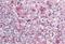 Leukocyte-associated immunoglobulin-like receptor 1 antibody, NBP1-68845, Novus Biologicals, Immunohistochemistry paraffin image 