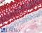 Rhodopsin antibody, LS-B10408, Lifespan Biosciences, Immunohistochemistry frozen image 