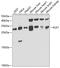 Kallikrein Related Peptidase 7 antibody, GTX33289, GeneTex, Western Blot image 