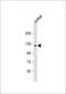 Protein Tyrosine Phosphatase Non-Receptor Type 21 antibody, 63-463, ProSci, Western Blot image 