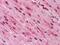 GATA Binding Protein 3 antibody, GTX82830, GeneTex, Immunohistochemistry paraffin image 