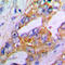 Aggrecan antibody, LS-C351811, Lifespan Biosciences, Immunohistochemistry paraffin image 