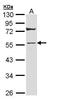 Keratin 7 antibody, PA5-29033, Invitrogen Antibodies, Western Blot image 