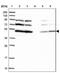 Solute Carrier Family 46 Member 3 antibody, NBP1-85054, Novus Biologicals, Western Blot image 