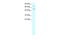 Protein Inhibitor Of Activated STAT 4 antibody, 27-769, ProSci, Western Blot image 