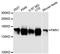 Formin 1 antibody, A13143, ABclonal Technology, Western Blot image 