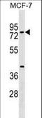 TOX High Mobility Group Box Family Member 4 antibody, LS-C157245, Lifespan Biosciences, Western Blot image 