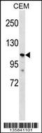 Polycystin 2 Like 1, Transient Receptor Potential Cation Channel antibody, 58-469, ProSci, Western Blot image 