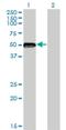 Zinc Finger Protein 71 antibody, H00058491-M01, Novus Biologicals, Western Blot image 