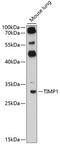 TIMP Metallopeptidase Inhibitor 1 antibody, 15-251, ProSci, Western Blot image 