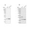 CGG Triplet Repeat Binding Protein 1 antibody, PA5-57916, Invitrogen Antibodies, Western Blot image 