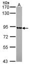 Polyribonucleotide Nucleotidyltransferase 1 antibody, LS-C186418, Lifespan Biosciences, Western Blot image 
