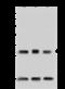 Ankyrin Repeat And SOCS Box Containing 9 antibody, 203710-T42, Sino Biological, Western Blot image 